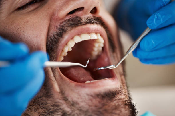 Best Emergency Tooth Extraction  in Hanscom Af, MA
